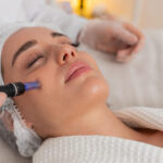 Microneedling benefits - Emmrey medical aesthetics