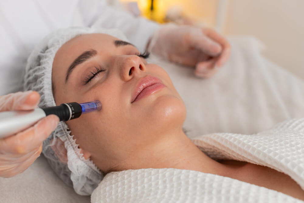 Microneedling benefits - Emmrey medical aesthetics