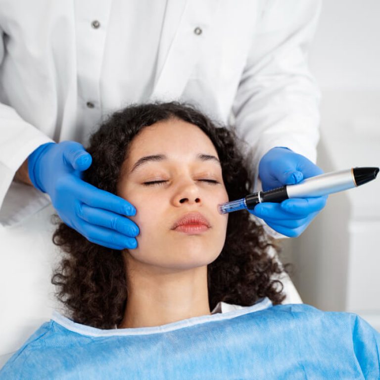 Microneedling Downtime - emmrey medical aesthetics